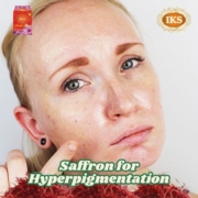 Saffron for Hyperpigmentation Nature’s Golden Solution