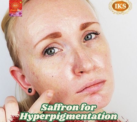 Saffron for Hyperpigmentation Nature’s Golden Solution